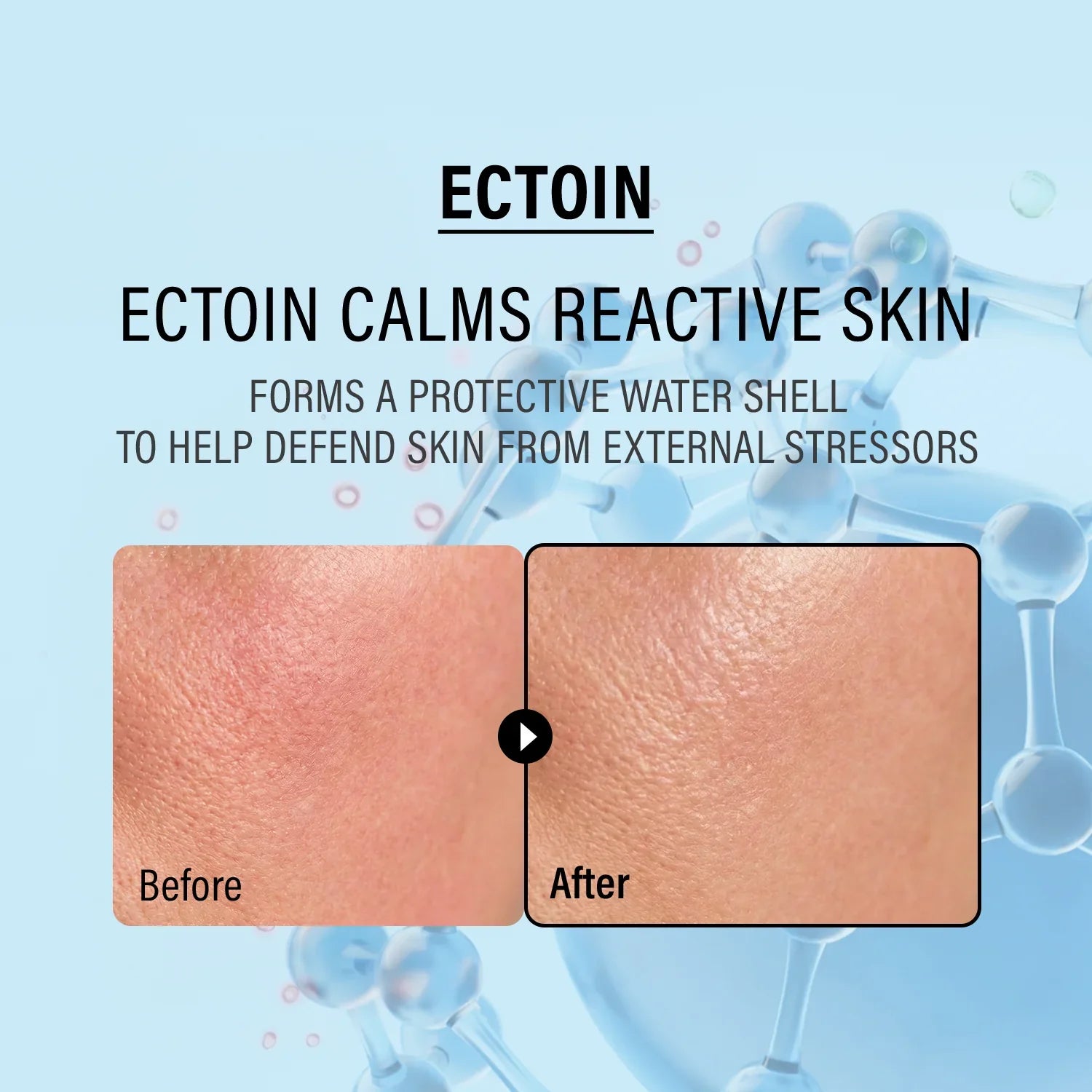 Epii Double Up Cream - Ectoin & Panthenol