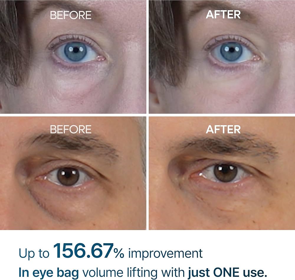 Dr. Melaxin Eyephalt Eyebag Cream 10ml