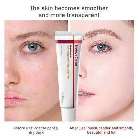 Madeca Cream
Time Reverse
