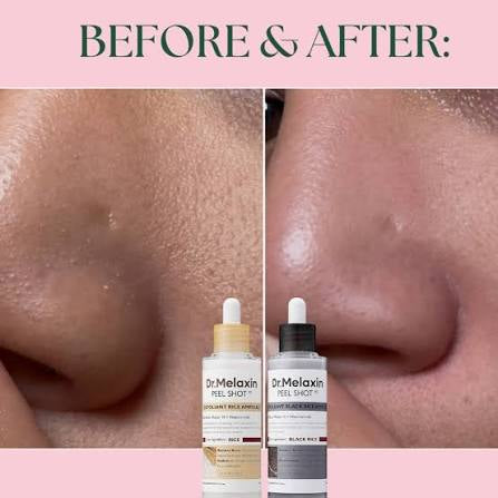 Dr. Melaxin Peel Shot Glow Black Rice Peeling Ampoule