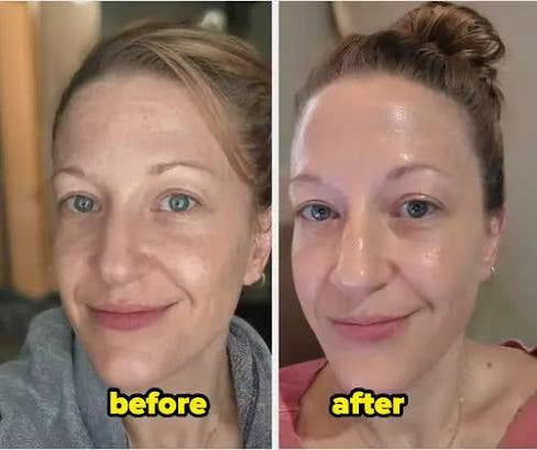 Dr. Melaxin Peel Shot Glow Black Rice Peeling Ampoule