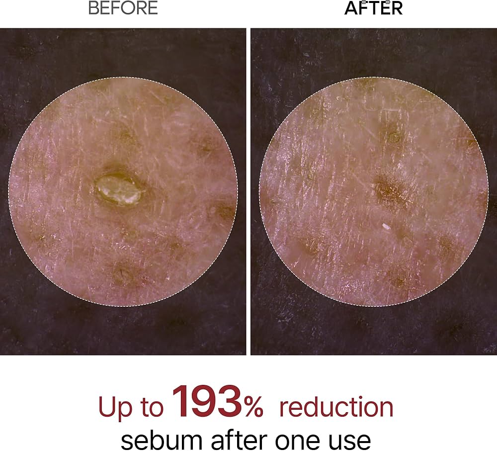 Dr. Melaxin Peel Shot Glow Black Rice Peeling Ampoule