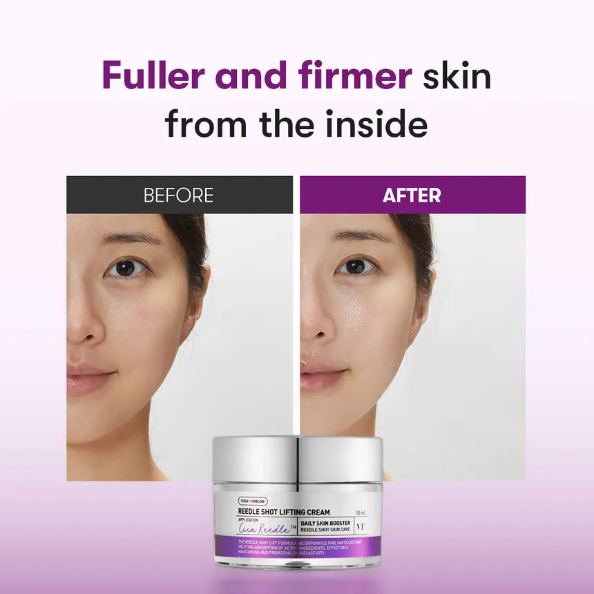 VT REEDLE SHOT LIFTING CREAM