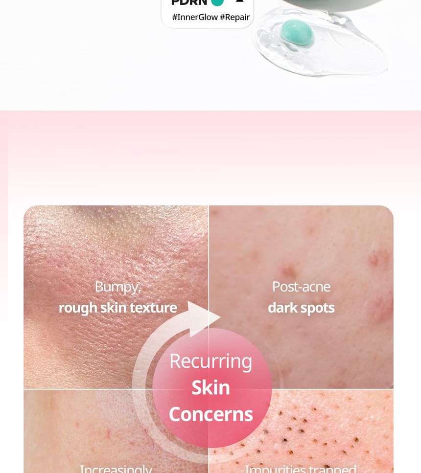 VT AZELAIC ACID Care Capsule Cream