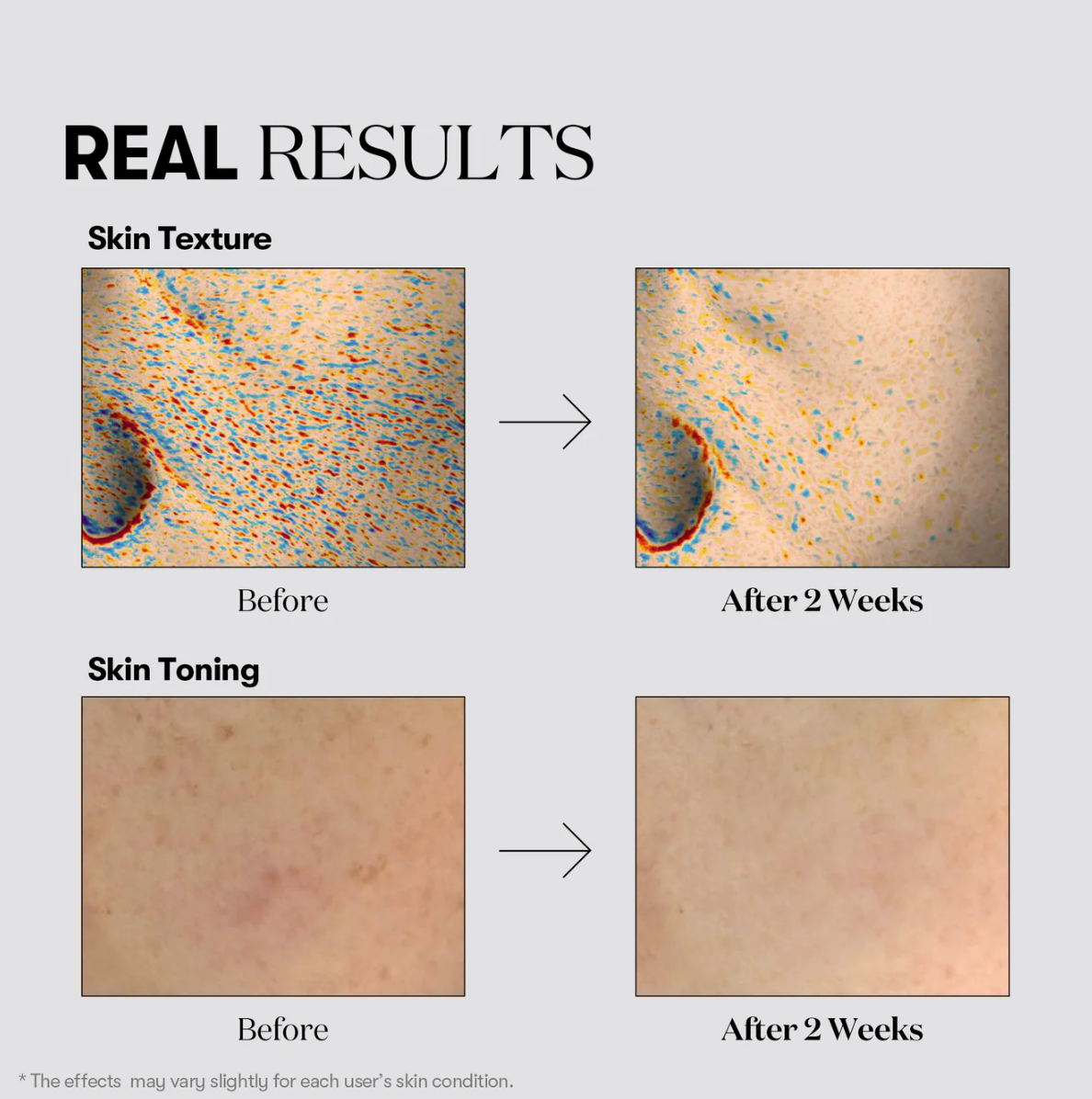 VT TX-TONING CREAM Repair & Moisturizing